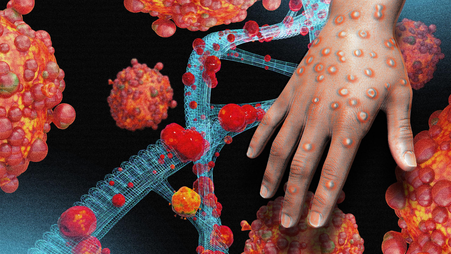 Ilustración 3D del virus de la viruela del mono, destacando su estructura y peligrosidad